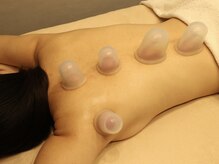 アントミョンス(Ant Myons)/カッピング　