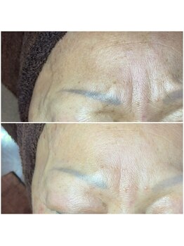 ソリシア(SORISIA)/