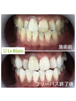 ルブラン 奈良店(Le Blanc)/納得いくフリーパスで