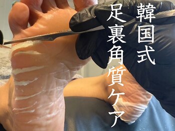 パッソ(Passo)の写真/タコ魚の目、もう悩まない！横須賀初◎韓国式足裏角質ケアで、かかとのざらつきもつるつるに！