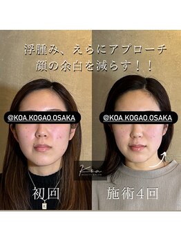 コア 心斎橋 堀江店(koa)/お客様ビフォーアフター