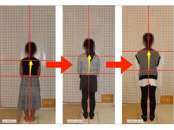リファイン(Refine)/肩の高さや軸の整う姿勢に