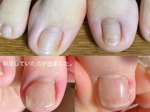 キラネイル アンド アイラッシュ by World Beauty(KIRA)/新潟巻爪