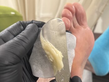 タソニ(DASONI)の写真/【角質ケアの最前線★韓国式角質除去】ガサガサかかと/痛いたこ/割れかかと/段差まで整えるDASONIの技術