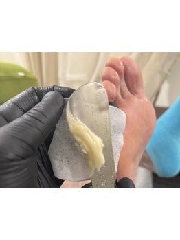 角質ケアができるサロン