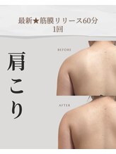 アメリオ(Amelio)/最新筋膜リリース1回30代後半