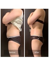 インナーメス(INNER MES)/全身徹底痩身！