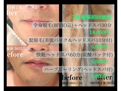 ミーエイト(Mii∞)の写真