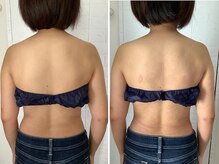 ビューティフルムーン(Beautiful Moon)/背面・一撃コース