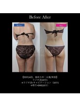 グラシアス/グラシアス | 症例写真