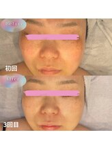 リーフ/プレミアムトリートメント