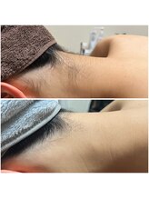 ルアナ(Luana)/うなじ美人