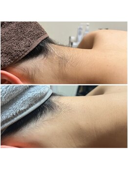 ルアナ(Luana)/うなじ美人