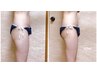 【半身】半身痩身60分×2回来店で脂肪分解35,000円→17,000円