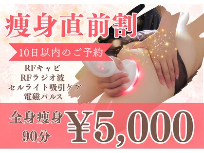 ミルキー(MiLuKy)の写真