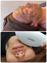 エアレ(eare)/【メンズ】陶肌+フォト