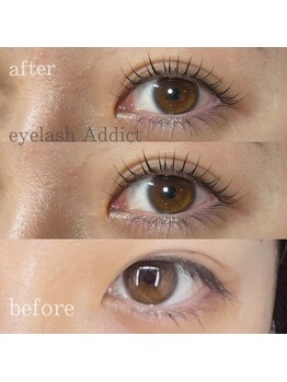 アディクト(Addict)/