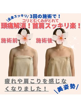 ミトラ(MITRA)/3回でスッキリ美しい姿勢に改善