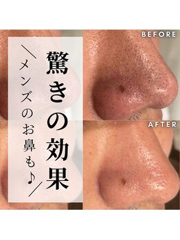 オリオンドットエスツー(Orion.S2)/【Before→After】