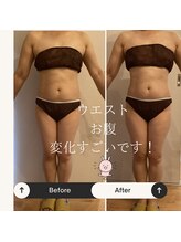 エイミー 藤ヶ丘店(Amy)/before→after