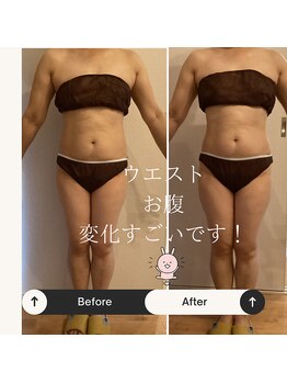 エイミー 藤ヶ丘店(Amy)/before→after