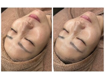 ユーイン 塩尻店(U-in)/ララピールビフォーアフター