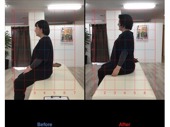 ストレチックス 近江八幡店/BeforeAfter