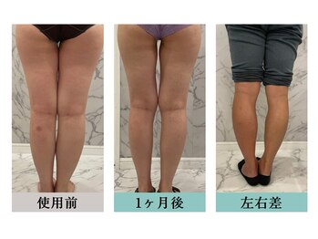 ハートランド(HEARTLAND)/