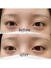 アイ(_i)/ラッシュリフト