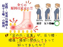 ヒューマン鍼灸接骨院/姿勢不良の原因は足元に