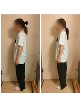 ラヴィフルリル(Ravi FleuRir)/美容整体の一回の変化