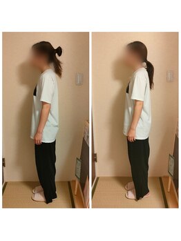 ラヴィフルリル(Ravi FleuRir)/美容整体の一回の変化