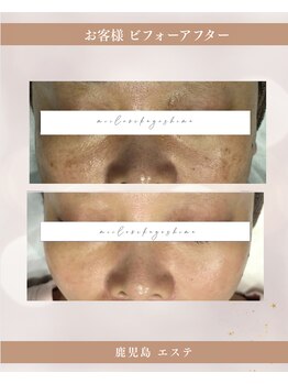 ミーラブ 鹿児島(miilove)/