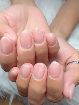 エイティピカル(Atypical)/ピーチ