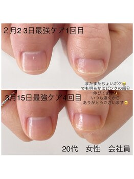 リバティー(liberty)/