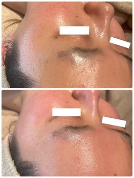 ディオーネ 春日井勝川店(Dione)/マーメイド☆ビフォーアフター