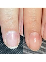 カラーネイルスタジオ(Callanail studio)/憧れての縦長のお爪へ♪