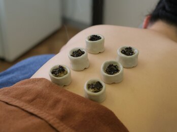 ひふみ鍼灸院/鍼施術