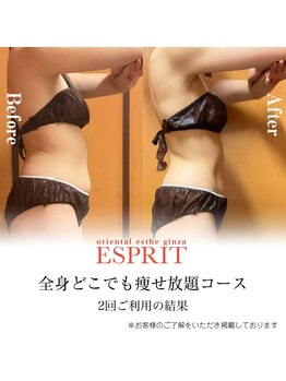 エスプリ 銀座店/全身どこでも痩せ放題2回