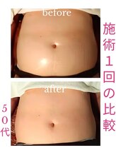 バービーホリック(barbie holic)/１６０分コース　１回の施術比較