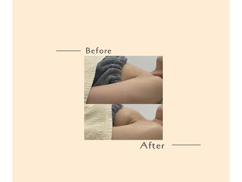 オベリオ(OBERIO)/