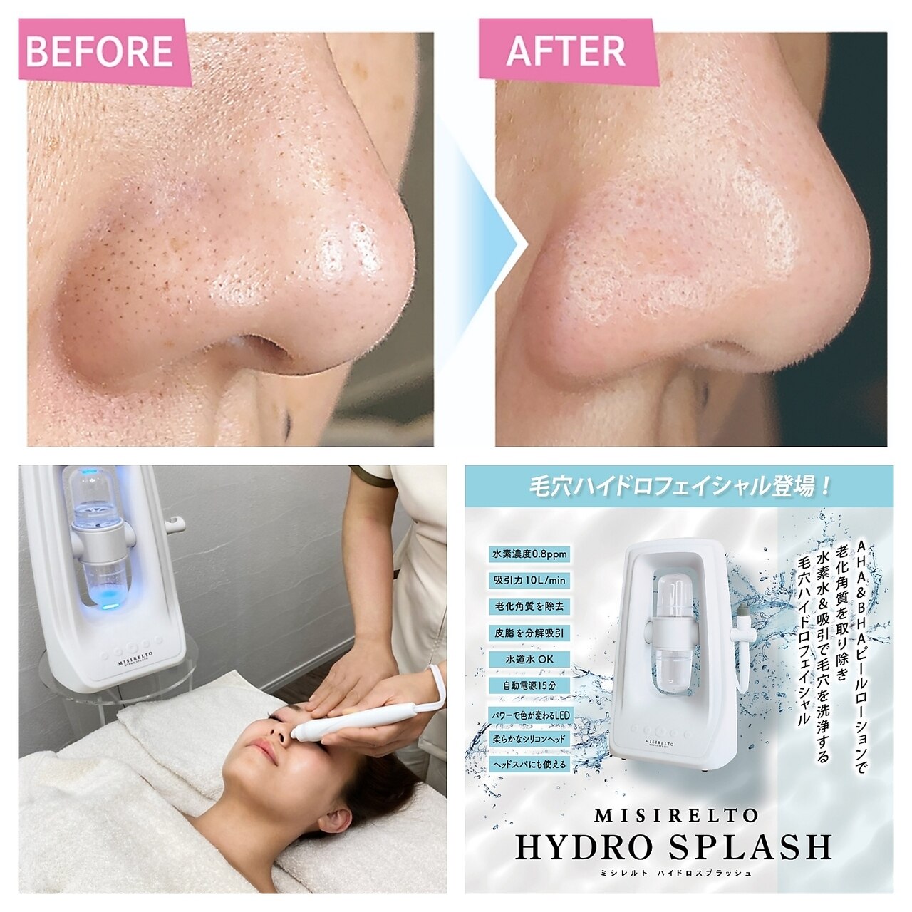 毛穴エステ 込900円 頬のたるみ毛穴、ありませんか？ | 毛穴ケア専門店 eclat