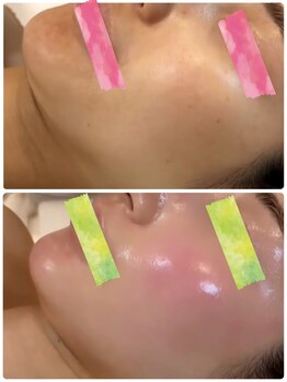 セラ(SERA)/セラピールケア