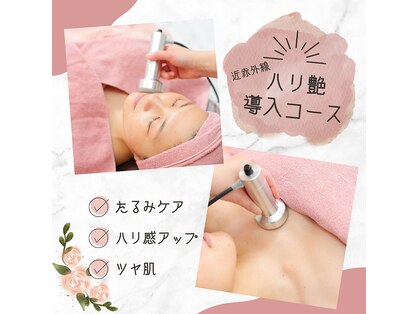 シュピネ(Choupinet)の写真