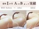 シエル(Siele)の写真/痩せたのに理想の体型じゃない…痩身こそ骨格から美ボディ!姿勢・歪みを整え女性らしいバストアップも♪