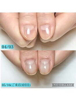 シャルム 本厚木(charme)/自爪育成ジェルコース