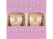 セレーネボーテプラス