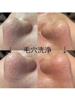 コウ鍼灸院(KOH鍼灸院)/