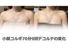 エスク(ESQUE)/デコルテの変化