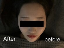 アンサー(ANSWER)/一度で分かる小顔矯正